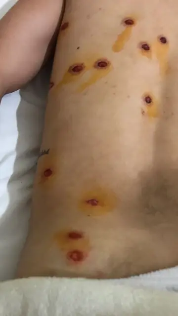 Heridas de Julián Gauna tras la los disparos de la policía Heridas de Julián Gauna tras la los disparos de la policía