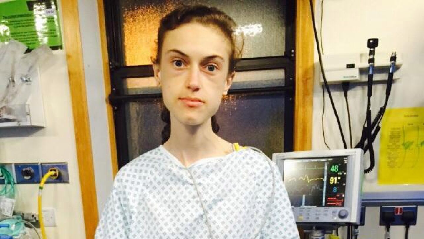 Emelle Lewis, la joven a la que Instagram salv&oacute; de la anorexia