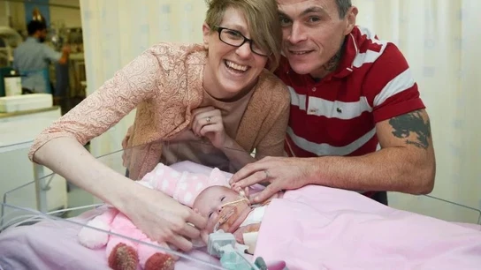 Bebé que nació con el corazón fuera del pecho Bebé que nació con el corazón fuera del pecho