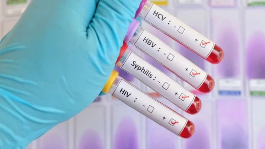 Infecciones de transmisión sexual Infecciones de transmisión sexual
