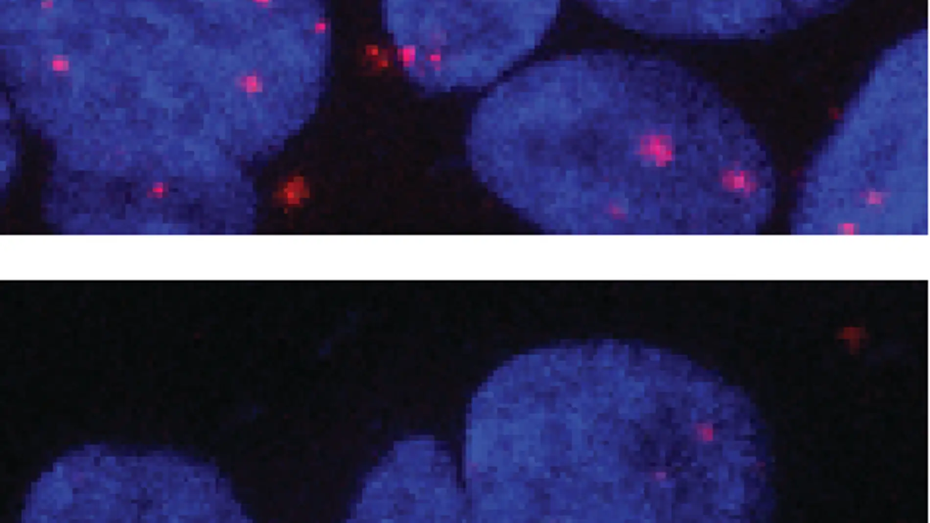 Receptor de andrógenos en el núcleo celular