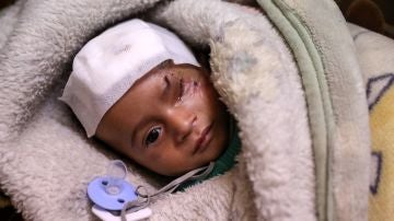 Karim, un niño herido en un bombardeo al este de Al-Guta