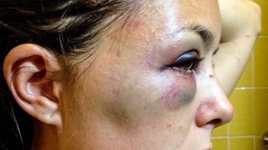 Andrea Carenzo, v&iacute;ctima de un ataque en Ecuador