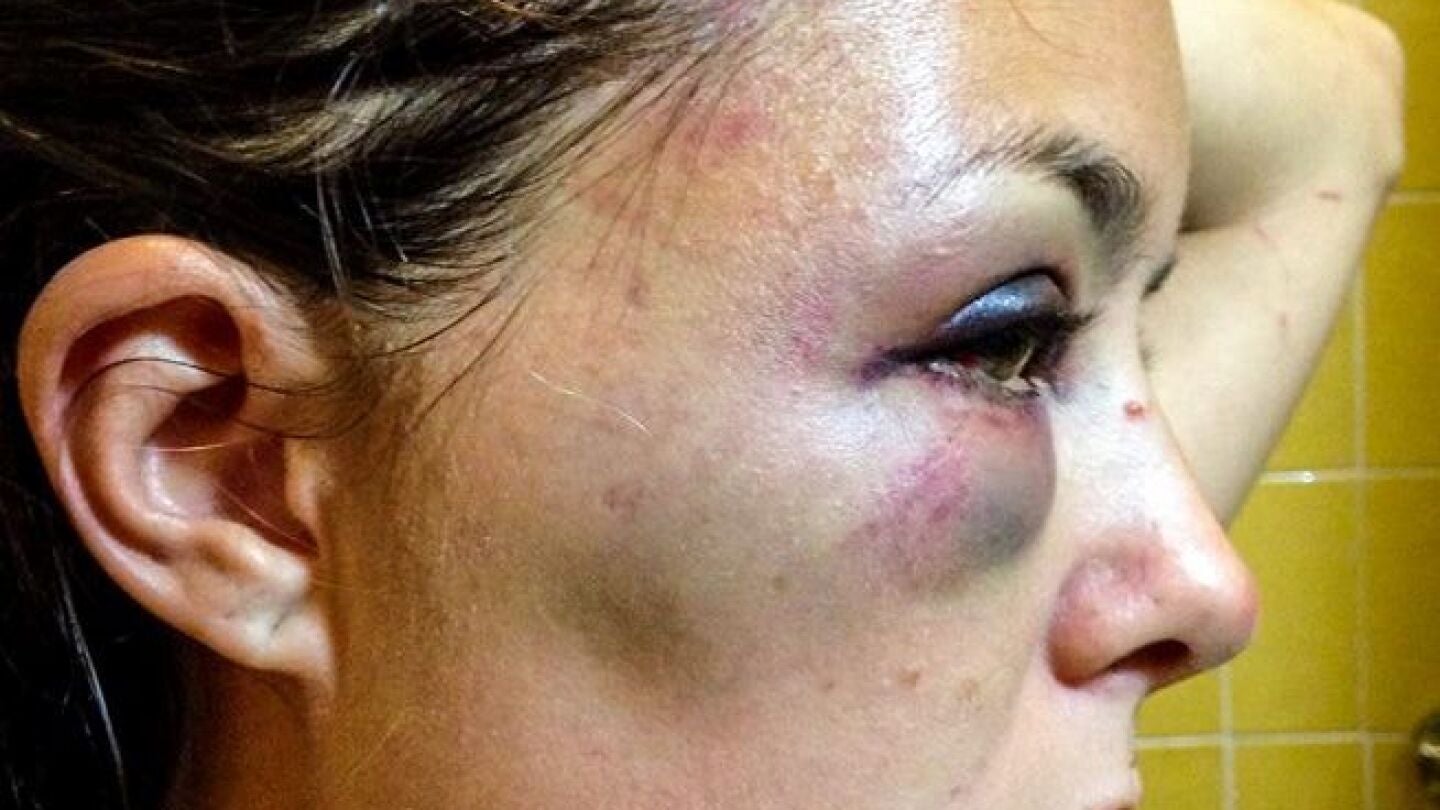 Andrea Carenzo, v&iacute;ctima de un ataque en Ecuador