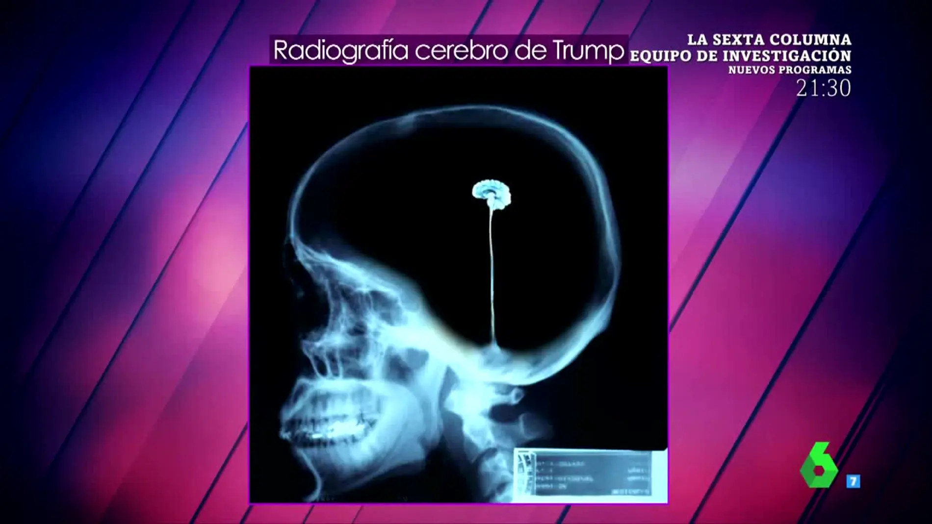 La doctora Carmen Rica Chona analiza el "pequeño" cerebro de Donald Trump