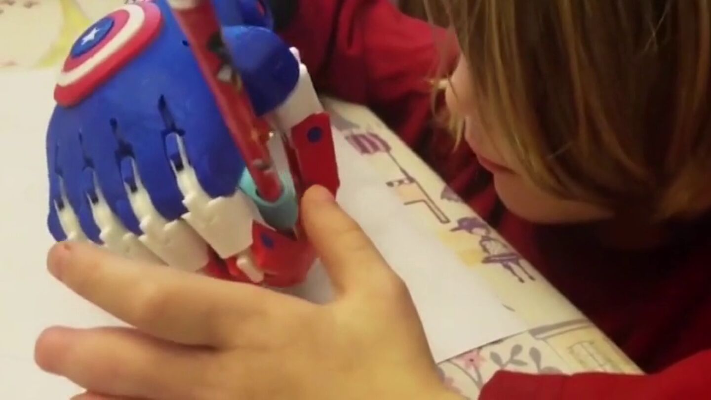 Un ni&ntilde;o de cinco a&ntilde;os dise&ntilde;a e imprime manos en 3D para ni&ntilde;os discapacitados