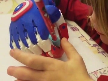 Un niño de cinco años diseña e imprime manos en 3D para niños discapacitados Un niño de cinco años diseña e imprime manos en 3D para niños discapacitados
