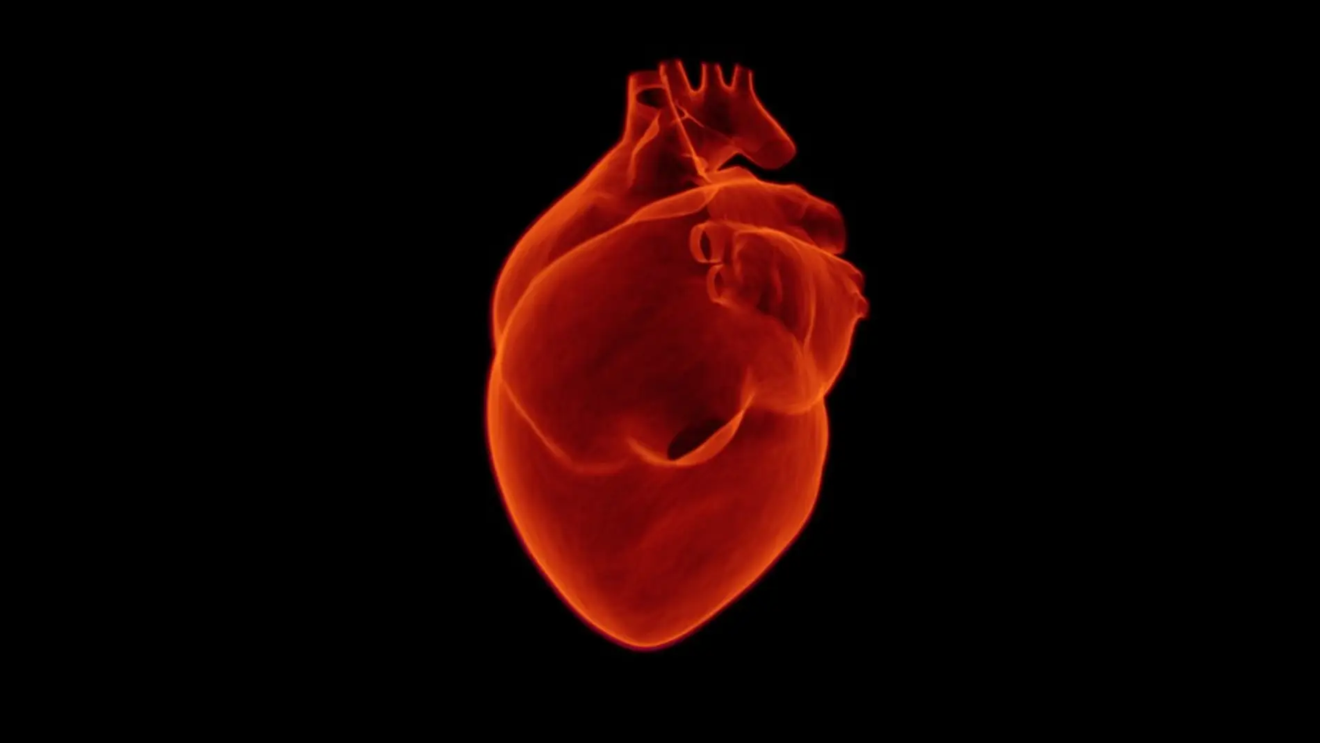 Que factores son clave para identificar el pronostico del infarto de miocardio