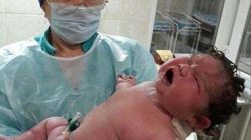Uno de los médicos sosteniendo a la bebé recién nacida