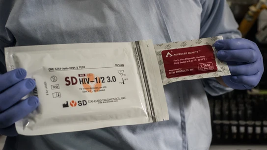Prueba del VIH Prueba del VIH