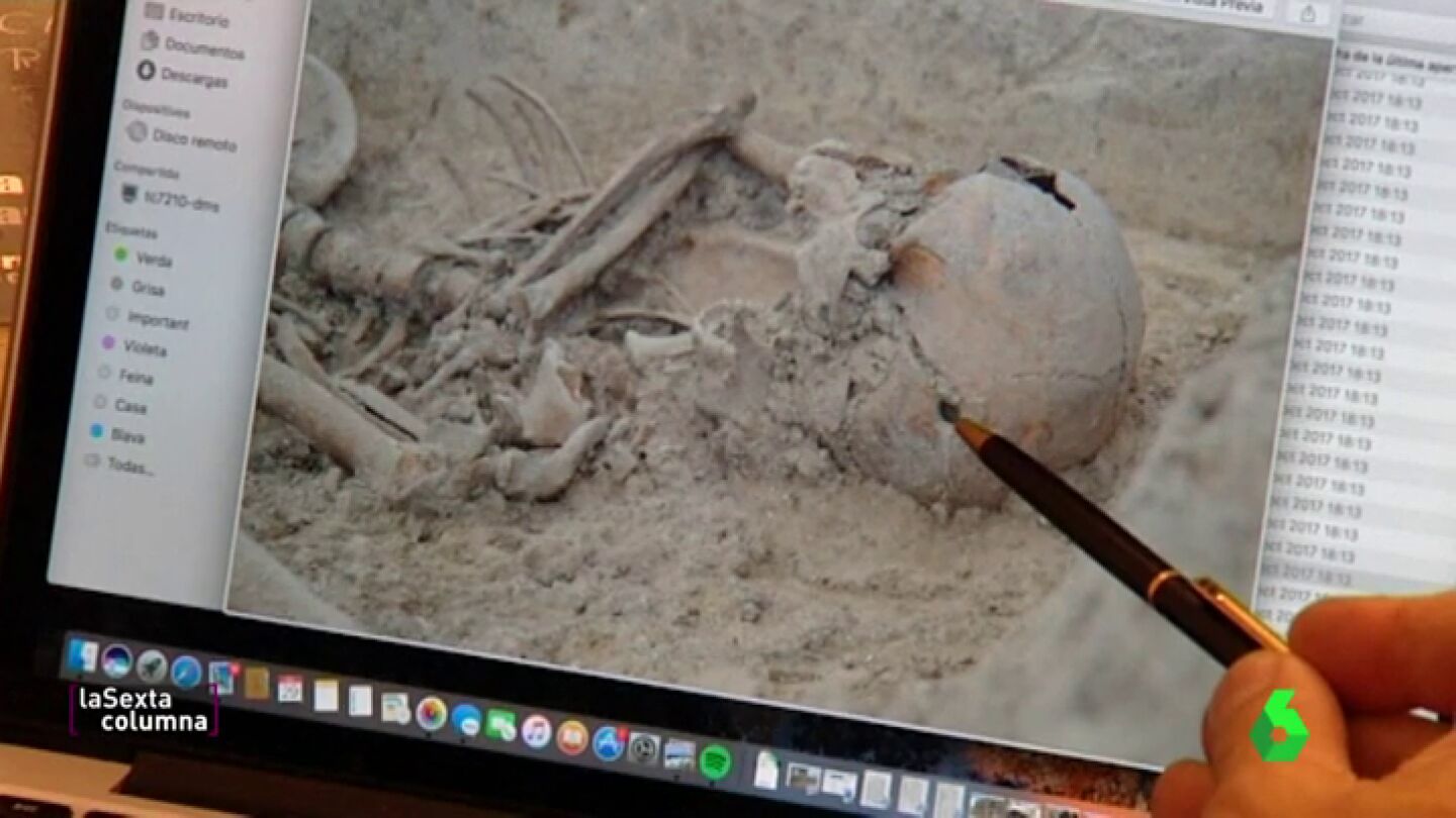 El cr&aacute;neo de una v&iacute;ctima del franquismo