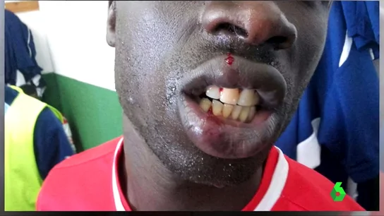 Nueva agresión racista en el fútbol español: "Me dijo que me iba a cortar las trencitas" Nueva agresión racista en el fútbol español: "Me dijo que me iba a cortar las trencitas"