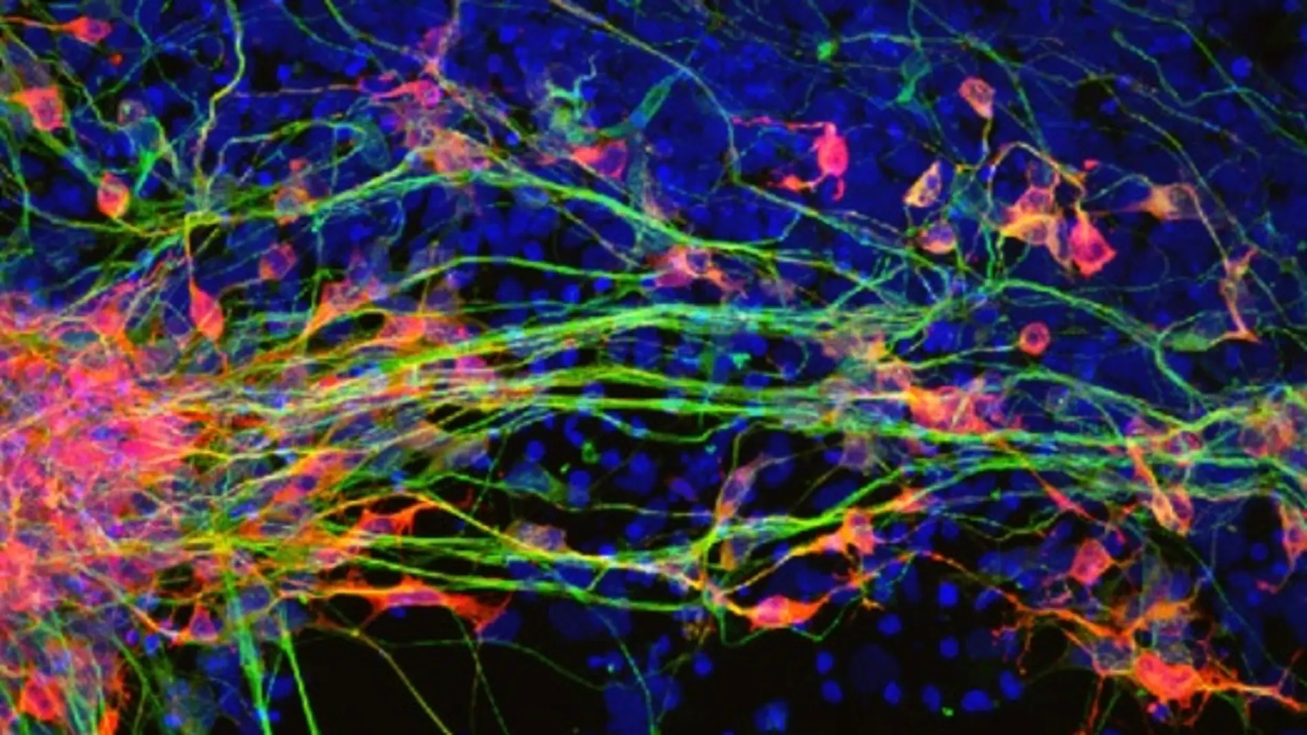 La proteina RAC1 nueva diana contra la degeneracion neuronal en parkinson