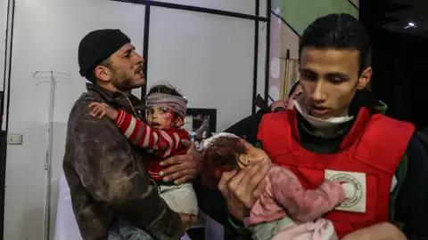 Niños heridos tras un bombardeo en Guta, Siria Niños heridos tras un bombardeo en Guta, Siria