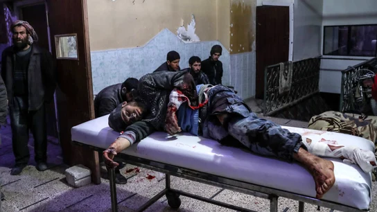 Un hombre herido tras un bombardeo al este de Guta Un hombre herido tras un bombardeo al este de Guta