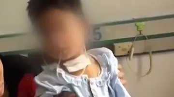 Una aguja atraviesa la garganta de un niño en China