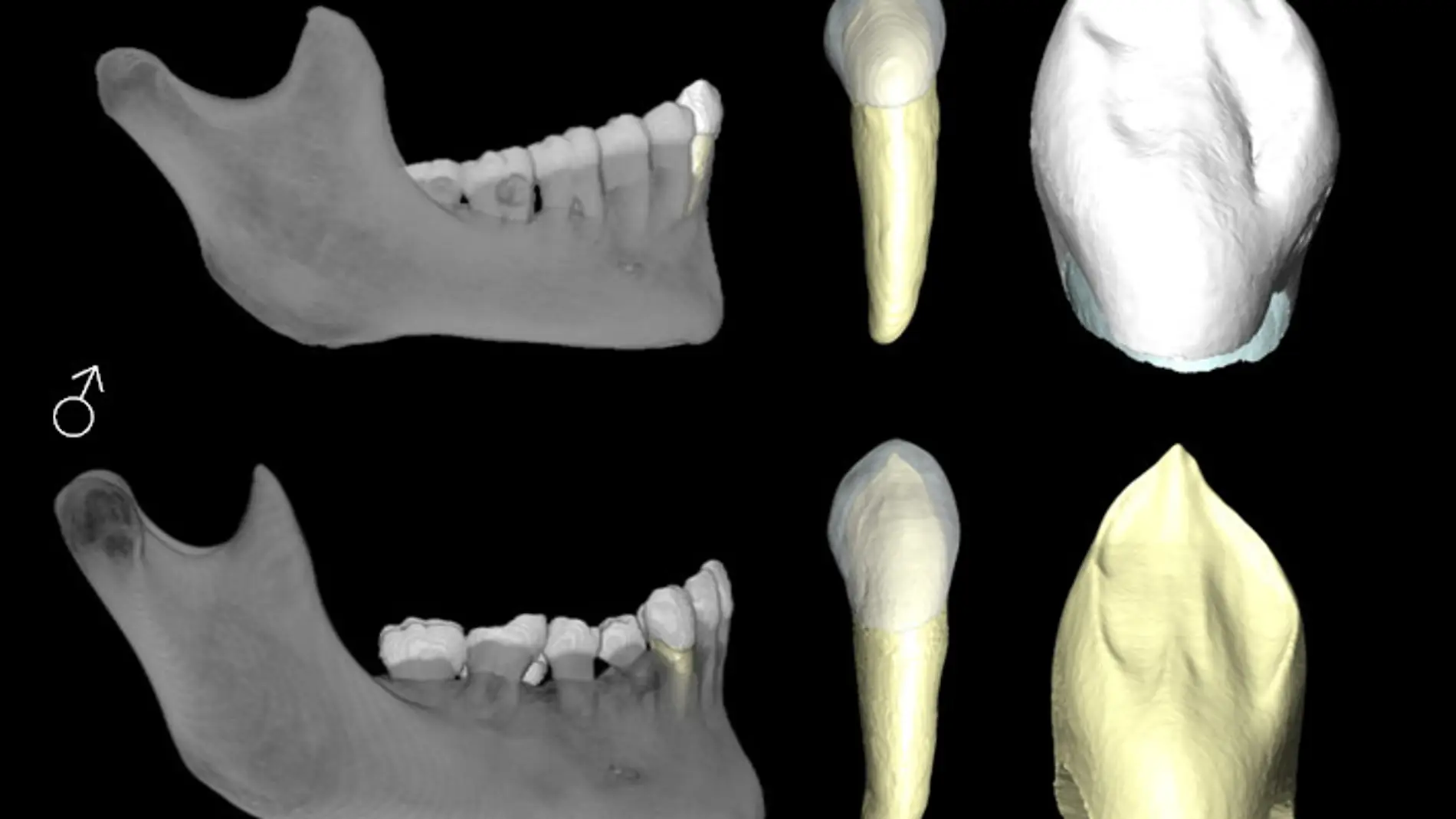 Un metodo forense identifica el sexo de restos humanos con una fiabilidad del 92