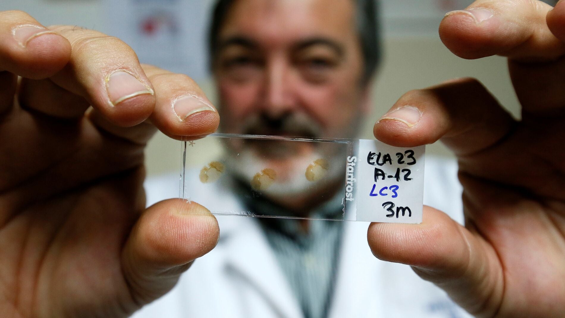 El director del departamento de Neurociencias, Salvador Martínez, muestra una placa con muestras de médula espinal enferma de ELA