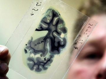 Un científico analiza una radiografía del cerebro humano. Un científico analiza una radiografía del cerebro humano.