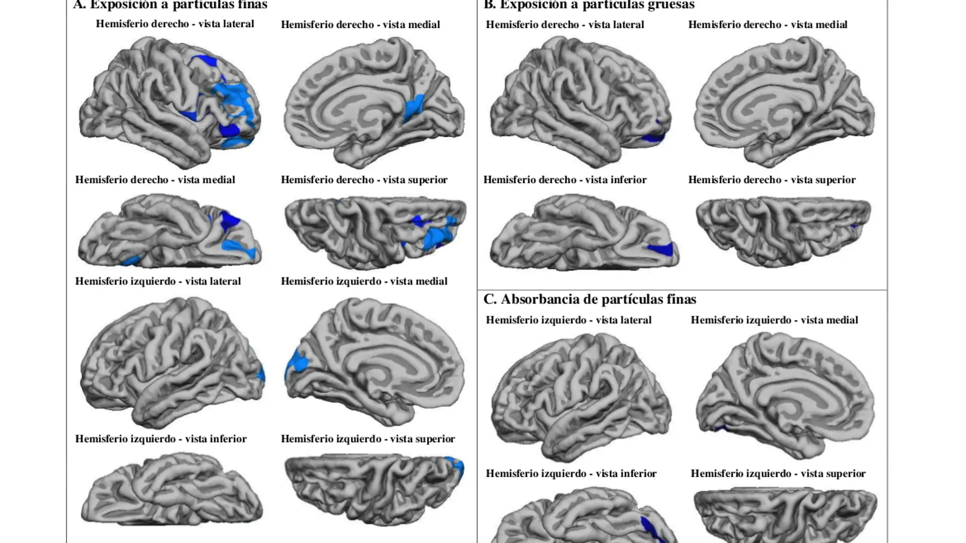 Imágenes que muestran las regiones cerebrales afectadas por las partículas finas y gruesas