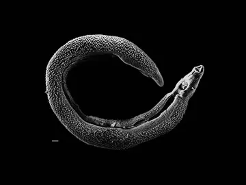Un grupo de 17 voluntarios ha sido infectado por el esquistosoma Un grupo de 17 voluntarios ha sido infectado por el esquistosoma