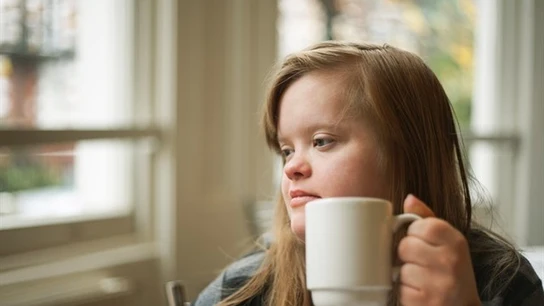 Una mujer con síndrome de Down Una mujer con síndrome de Down