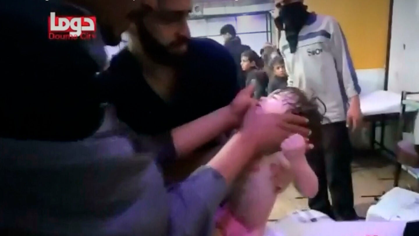 Ni&ntilde;os atendidos tras el ataque qu&iacute;mico en Duma