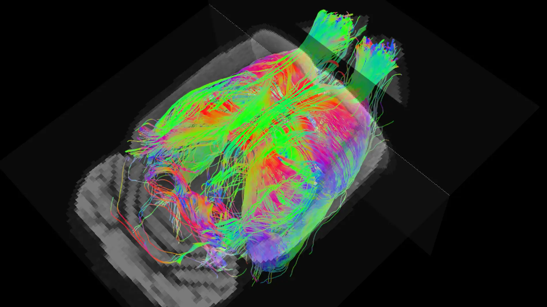 Fibras cerebrales del cerebro de una rata