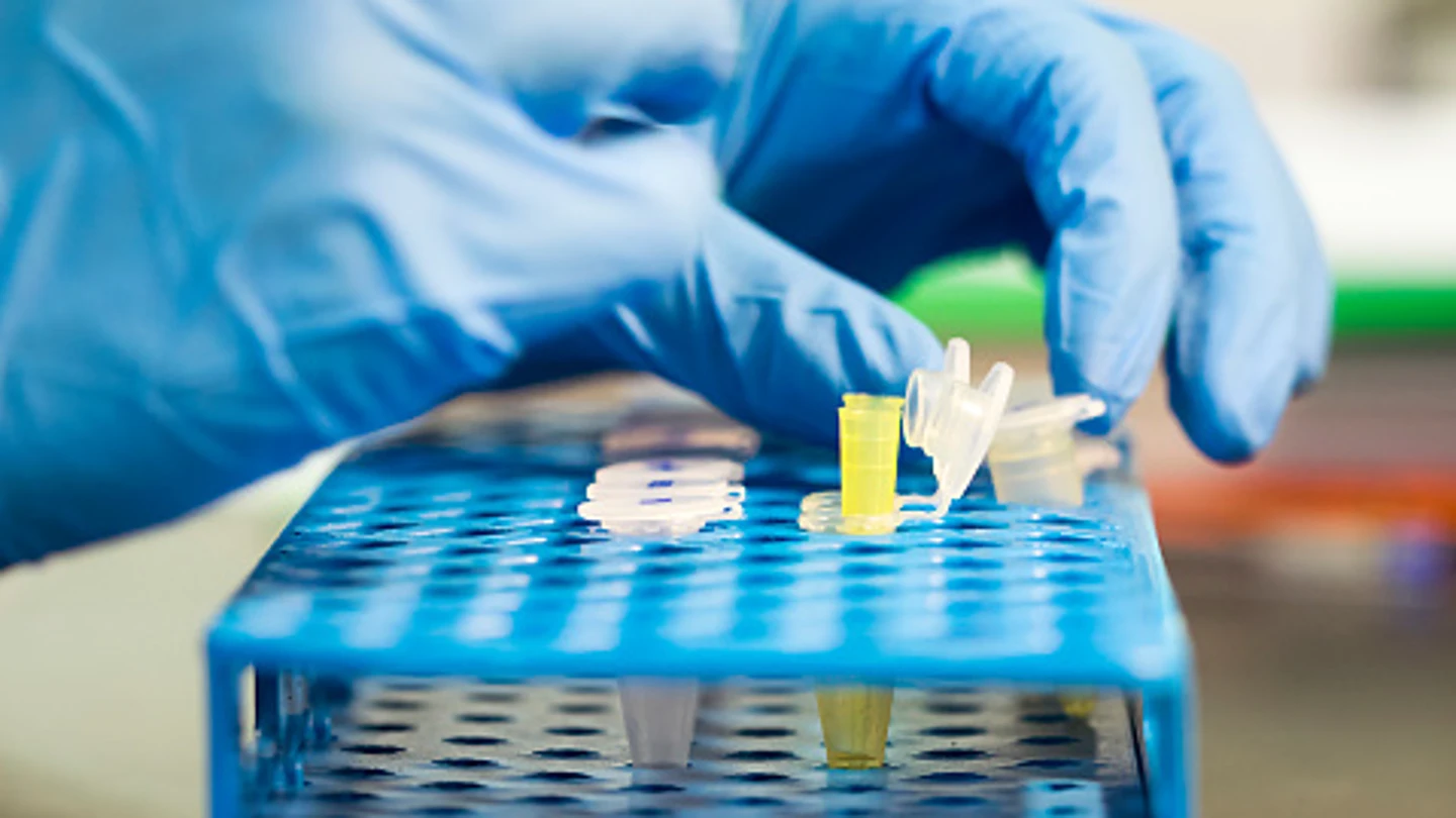 Fiebre, diarrea y dolor articular son los síntomas más comunes de la tularemia Un investigador en un laboratorio