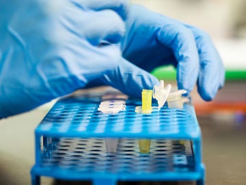Fiebre, diarrea y dolor articular son los síntomas más comunes de la tularemia Fiebre, diarrea y dolor articular son los síntomas más comunes de la tularemia