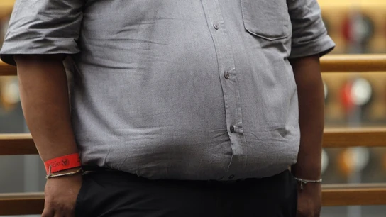 Vista de una persona con obesidad Vista de una persona con obesidad