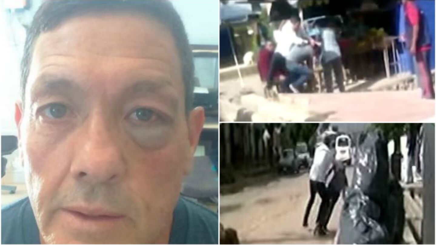 As&iacute; qued&oacute; el ojo del seleccionador tras la pelea callejera