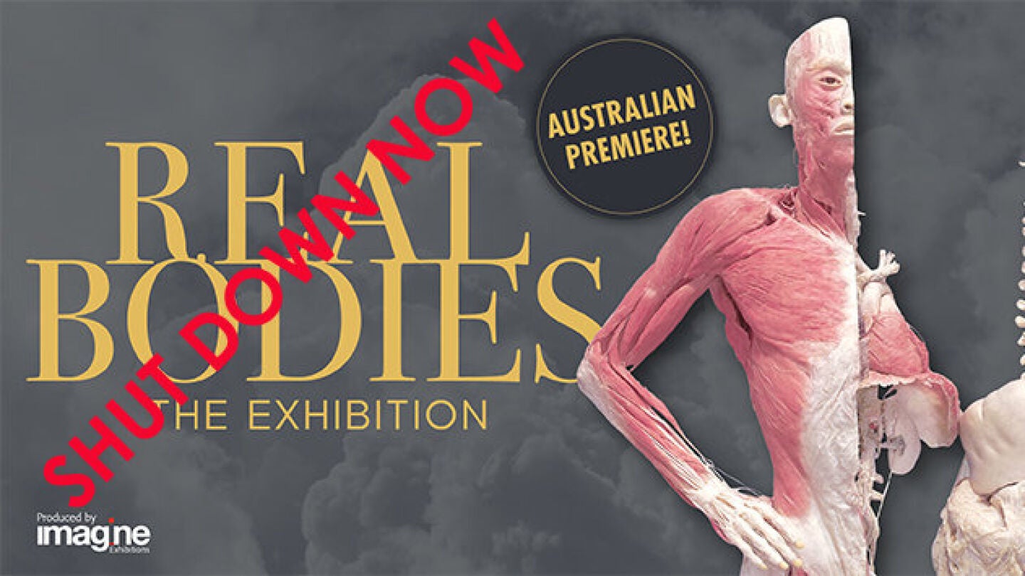 Campa&ntilde;a contra la exposici&oacute;n "Real Bodies"
