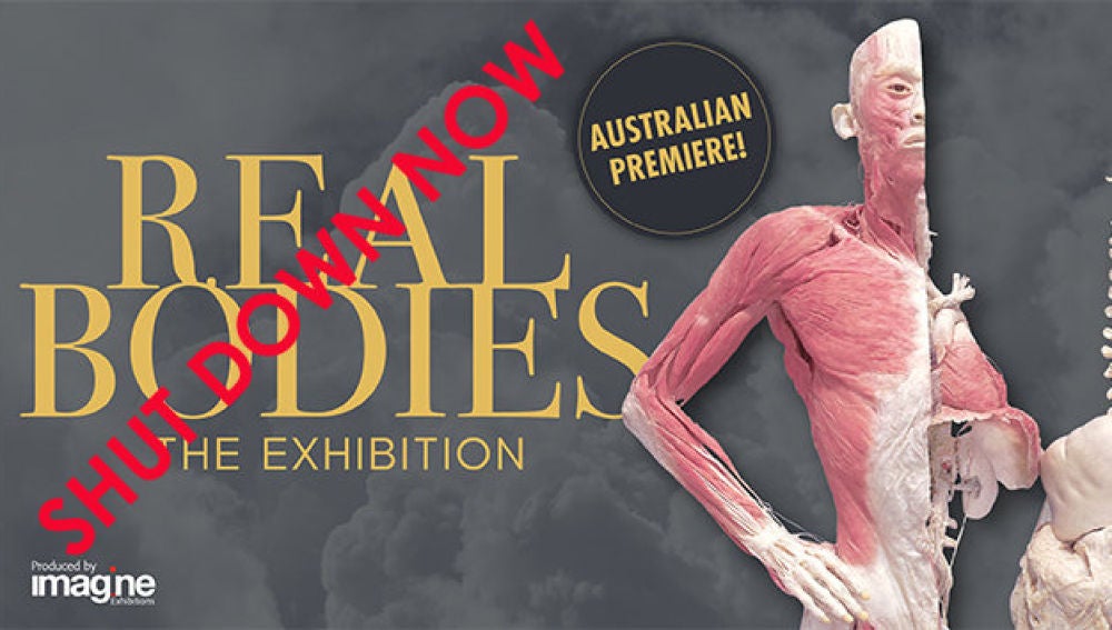 Campaña contra la exposición "Real Bodies"