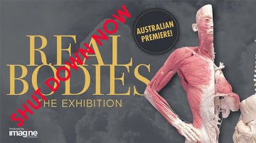 Campaña contra la exposición "Real Bodies"