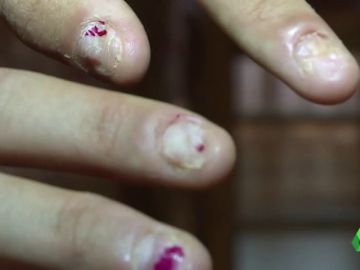 Absueltas por bullying dos menores en Madrid Absueltas por bullying dos menores en Madrid