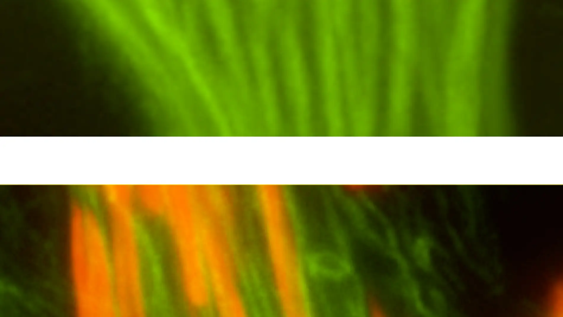 Identifican una proteina clave en el ensamblaje de la cola de los espermatozoides