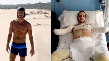 El joven Davide antes y después de ser amputado