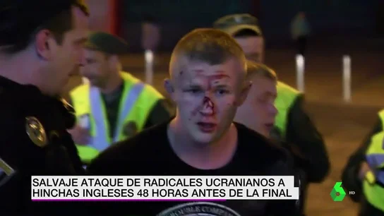 Un grupo de ultras rusos agreden a seguidores del Liverpool en Kiev Un grupo de ultras rusos agreden a seguidores del Liverpool en Kiev