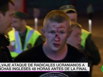 Un grupo de ultras rusos agreden a seguidores del Liverpool en Kiev Un grupo de ultras rusos agreden a seguidores del Liverpool en Kiev