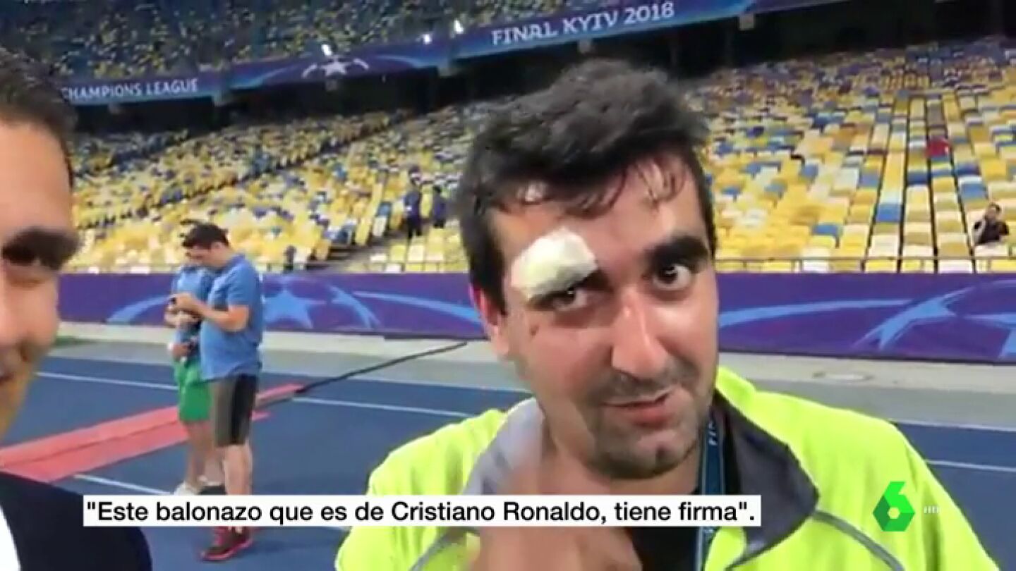El gran gesto de Cristiano con un c&aacute;mara tras abrirle la ceja de un pelotazo