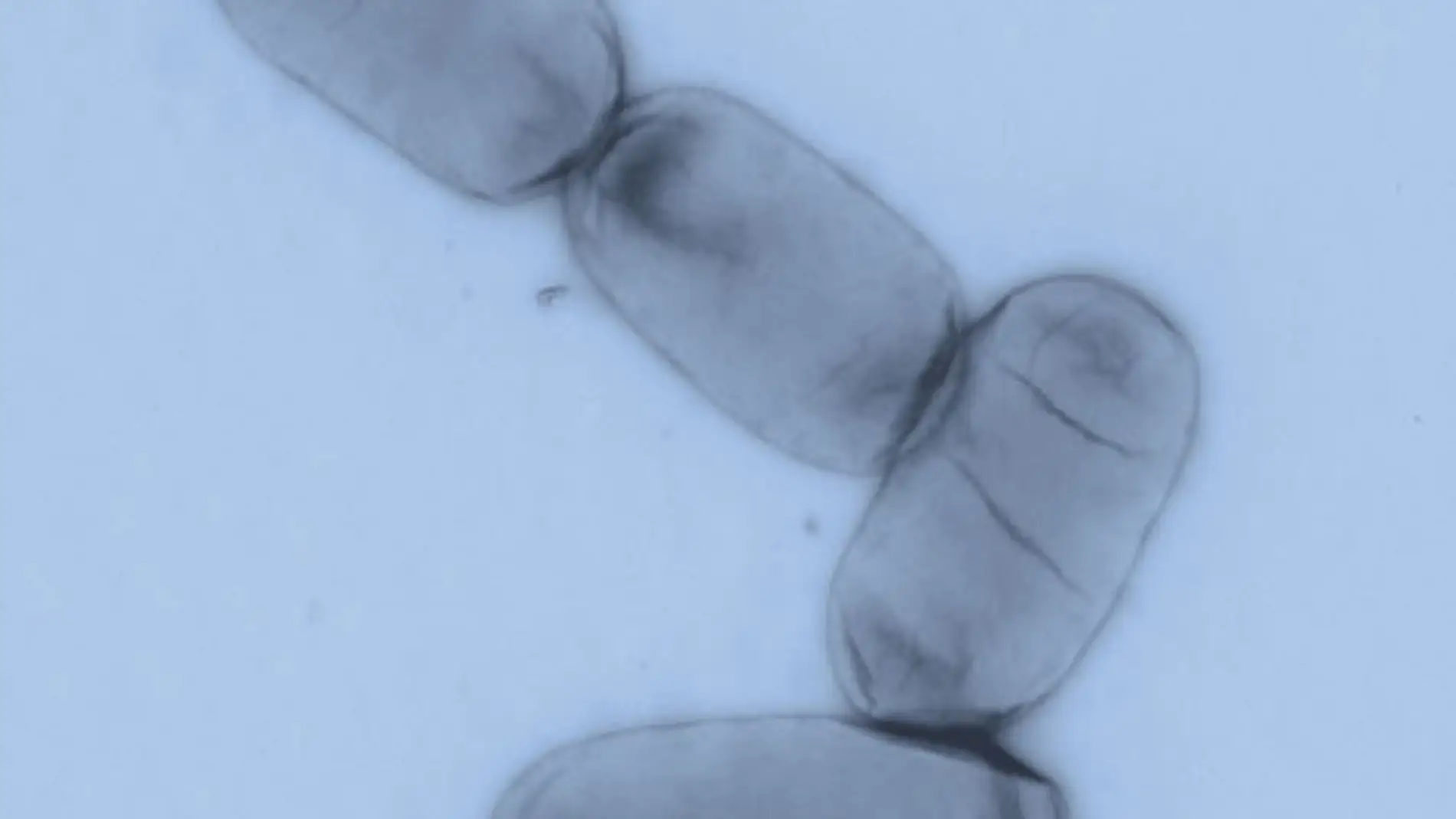 Salmonella enterica es uno de los principales patógenos entéricos tanto en países desarrollados como en regiones en vías de desarrollo.