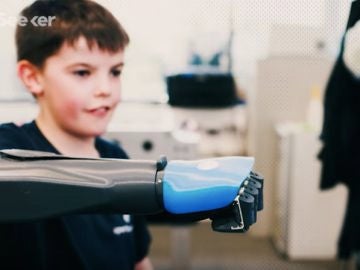 Unos ingenieros crean en 3D un brazo mecánico que evoluciona con la edad del niño