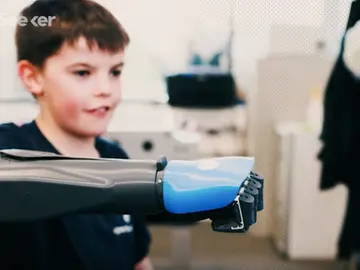 Unos ingenieros crean en 3D un brazo mecánico que evoluciona con la edad del niño Unos ingenieros crean en 3D un brazo mecánico que evoluciona con la edad del niño