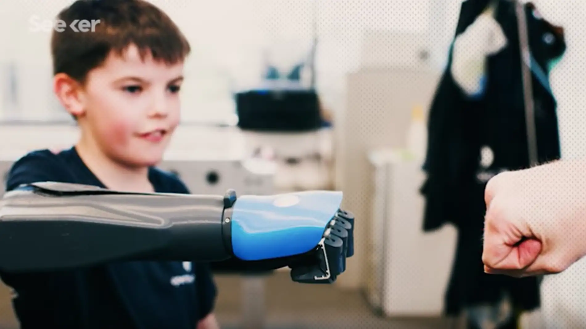 Unos ingenieros crean en 3D un brazo mecánico que evoluciona con la edad del niño