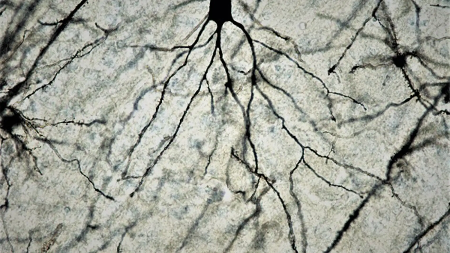 Neurona de cerebro de ratón a 100x tras tinción de Golgi-Cox. / Facultad de Medicina UCM.