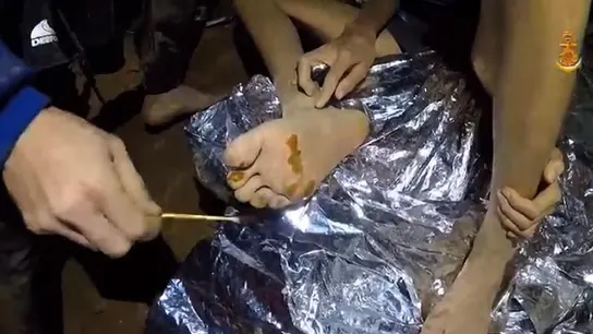 Tratan a uno de los niños atrapados en una cueva de Tailandia Tratan a uno de los niños atrapados en una cueva de Tailandia