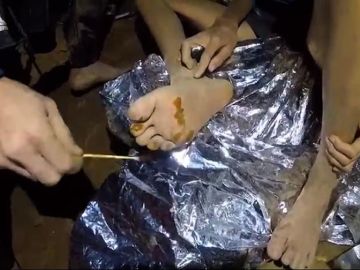 Tratan a uno de los niños atrapados en una cueva de Tailandia Tratan a uno de los niños atrapados en una cueva de Tailandia