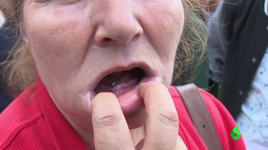 El cierre de iDental deja a miles de pacientes con tratamientos a medias: "Decían que era para gente sin recursos pero ahora me toca irme a otro dentista y pagar 3.000 euros" El cierre de iDental deja a miles de pacientes con tratamientos a medias: "Decían que era para gente sin recursos pero ahora me toca irme a otro dentista y pagar 3.000 euros"