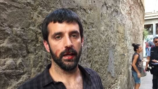 El fotoperiodista Jordi Borr&agrave;s denuncia que un polic&iacute;a le agredi&oacute;
